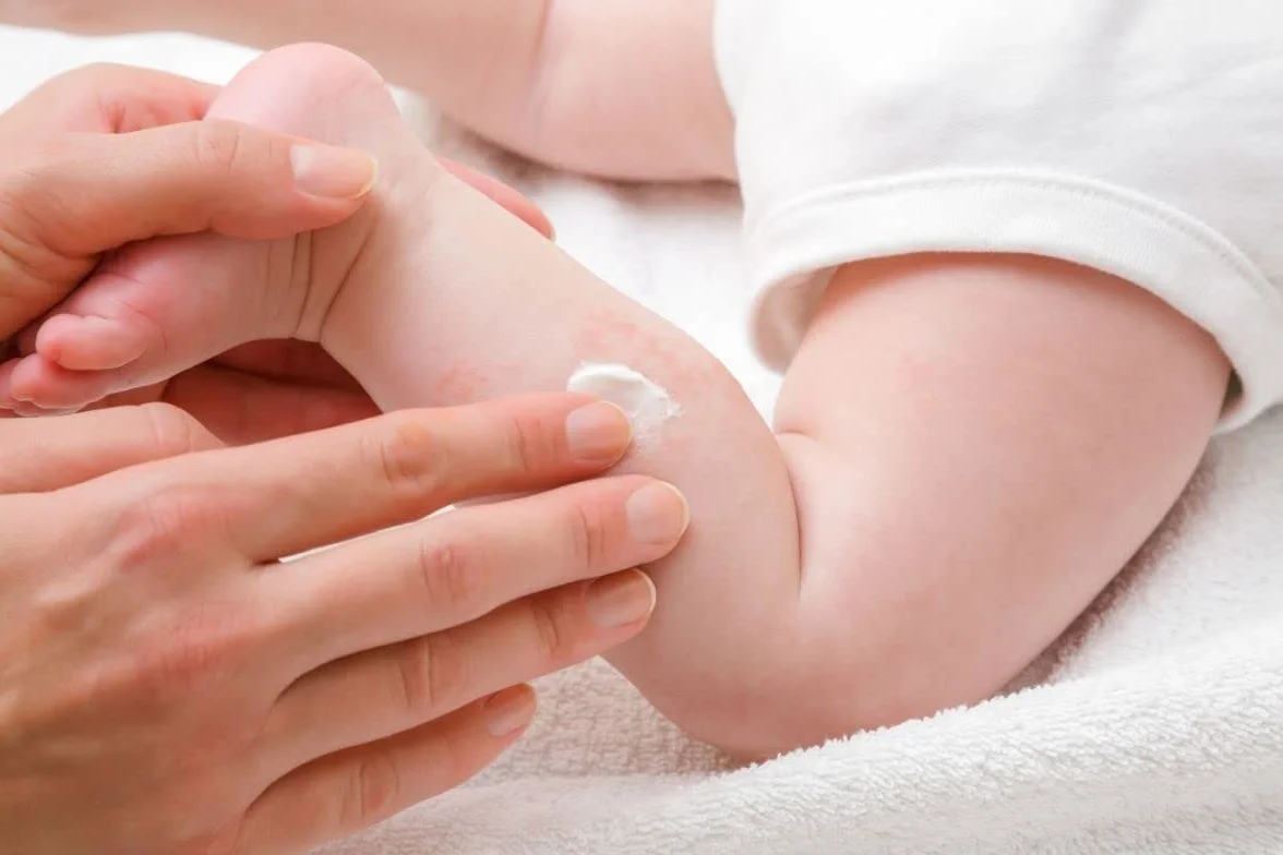 Dr. Pavlovic oryginalny krem dla niemowląt – leczenie pieluszek, nawilżanie suchej skóry, maść do pielęgnacji skóry niemowląt z rumiankiem 100 ml