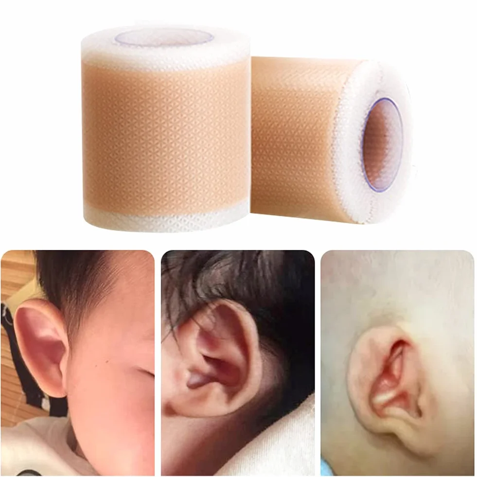 Surakey Silikonowy plaster do korekcji estetycznych uszu dla noworodków, niemowląt, wystający plaster na ucho, oddychający plaster na uszy, 4 x 50 cm